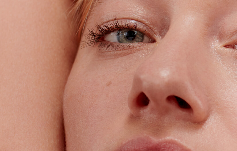 Shed Some Light On Dark Circles Shed Some Light On Dark Circles